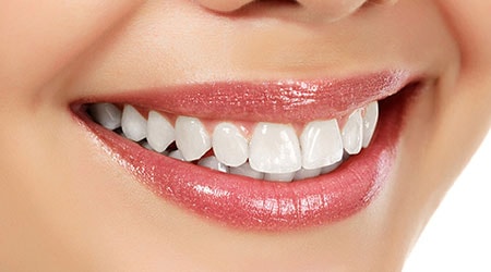 Beautiful teeth thanks to cosmetic dentistry