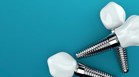 Dental implants, which replace missing teeth
