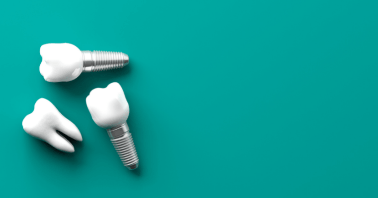 Dental implants examples on teal background